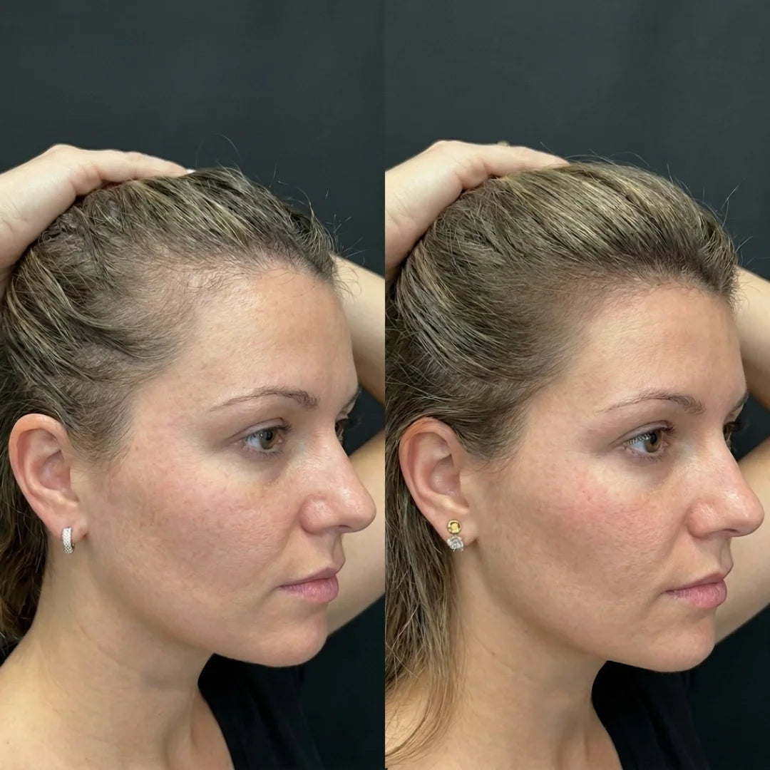 Comparaison entre Feminova et les compléments cheveux classiques